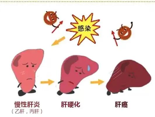 樱花草视频在线观看高清视频厂家提醒肝脏疾病治不好？要了解是否含铁食物摄入多